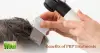 Why Many Choose PRP Treatment for Hair Loss