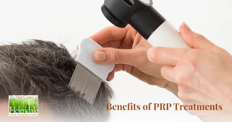Why Many Choose PRP Treatment for Hair Loss
